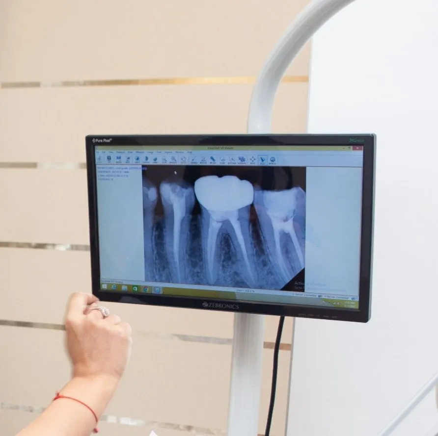 Digital X-ray displayed on screen at i-Smile